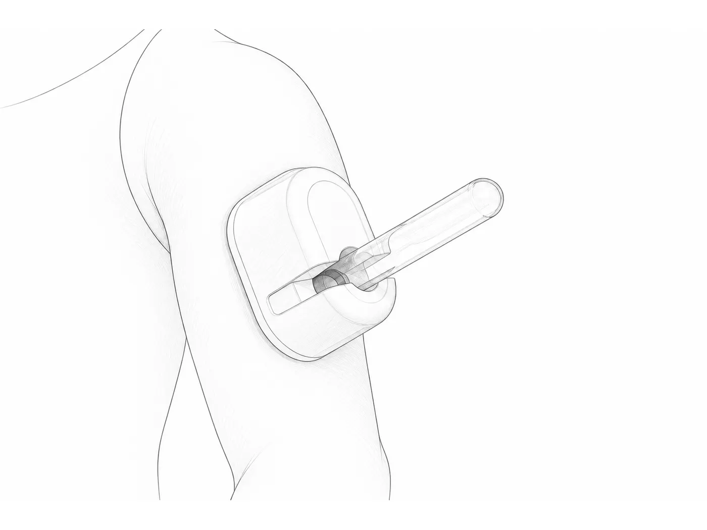 Dibujo a lápiz de la toma de muestra en el brazo